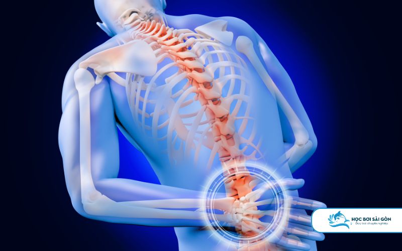 Sai Kỹ Thuật Khiến Đau Cột Sống